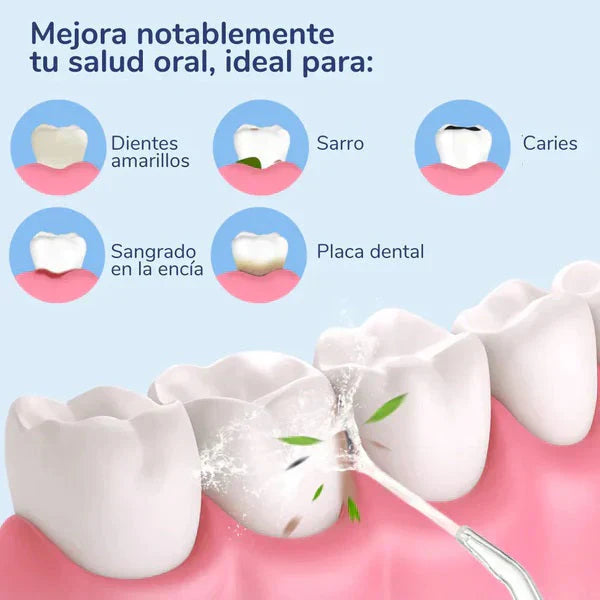 PowerClean® | Irrigador Dental | La Solución para una Higiene Bucal.